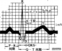 心电图