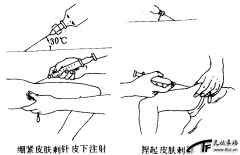 皮下注射法